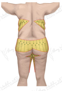 Fem 2 Before (Back) logo