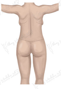 Fem After Back+ logo