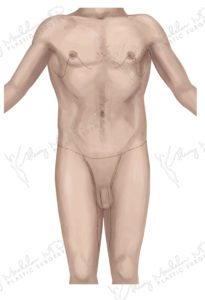 Male 3 After Front logo